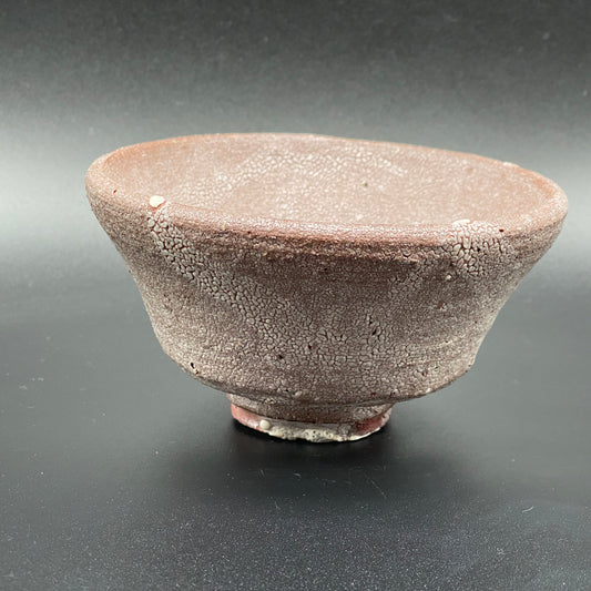 顴